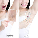 Load image into Gallery viewer, 5-in-1 Female Shaving Machine
