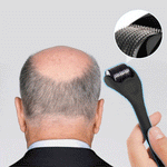 Load image into Gallery viewer, Hair Re-Activating Roller
